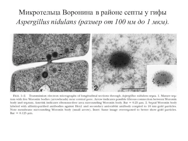 Микротельца Воронина в районе септы у гифы Aspergillus nidulans (размер от 100 нм до 1 мкм).
