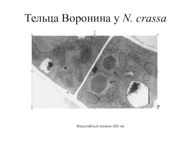 Тельца Воронина у N. crassa Масштабный отрезок 500 нм.