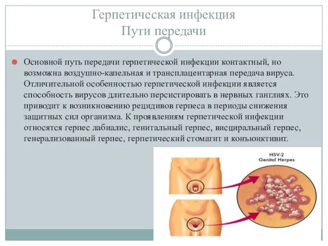 Герпетическая инфекция Пути передачи Основной путь передачи герпетической инфекции контактный,