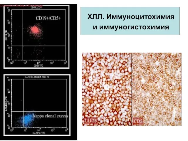 ХЛЛ. Иммуноцитохимия и иммуногистохимия