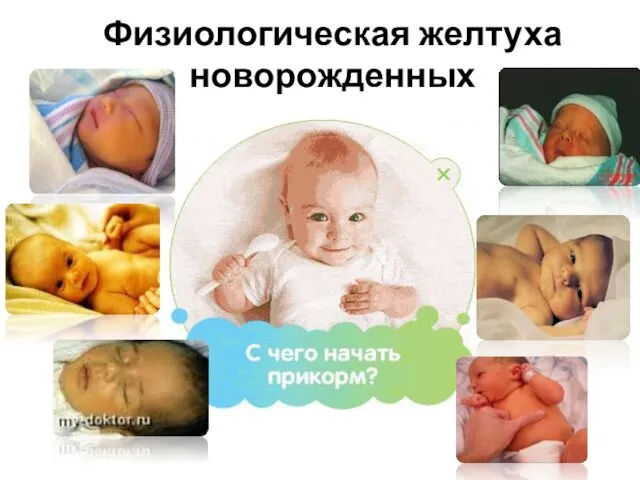 Физиологическая желтуха новорожденных