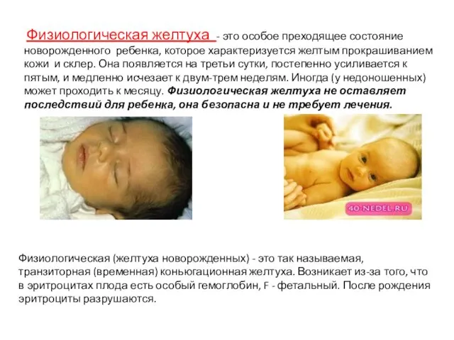 Физиологическая желтуха - это особое преходящее состояние новорожденного ребенка, которое характеризуется желтым прокрашиванием