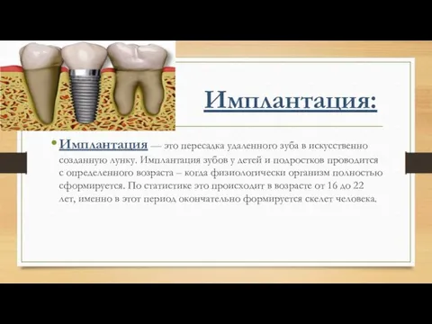 Имплантация: Имплантация — это пересадка удаленного зуба в искусственно созданную