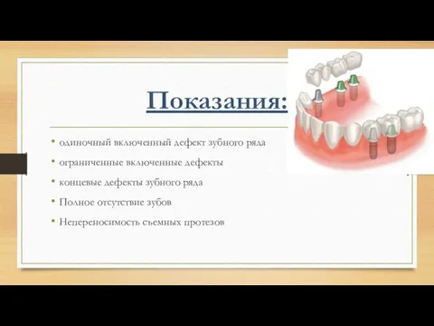 Показания: одиночный включенный дефект зубного ряда ограниченные включенные дефекты концевые дефекты зубного ряда