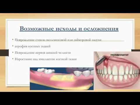 Возможные исходы и осложнения Повреждение стенок околоносовой или гайморовой пазухи