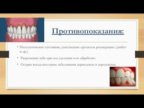 Противопоказания: Патологические состояния, угнетающие процессы регенерации (диабет и др.). Разрушение зуба при его