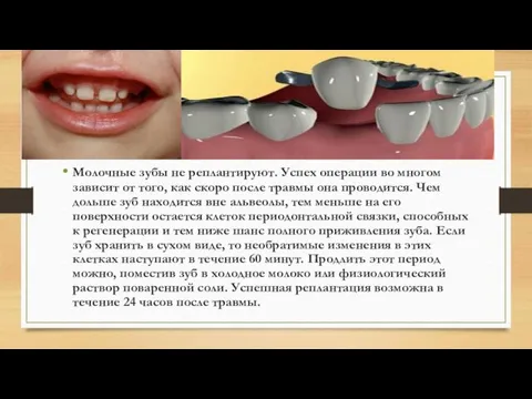 Молочные зубы не реплантируют. Успех операции во многом зависит от