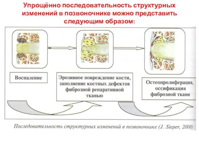 Упрощённо последовательность структурных изменений в позвоночнике можно представить следующим образом: