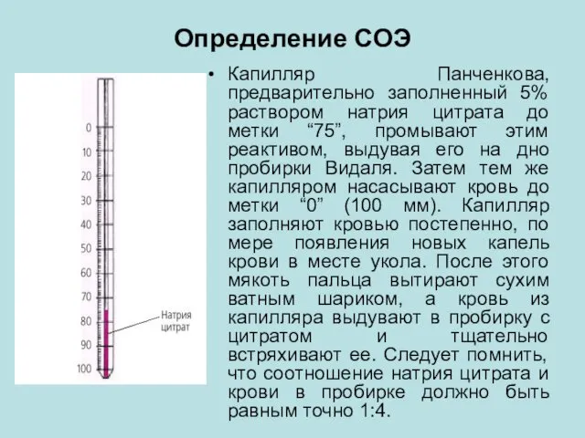 Определение СОЭ Капилляр Панченкова, предварительно заполненный 5% раствором натрия цитрата