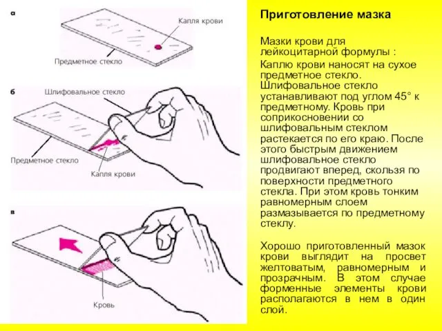 Приготовление мазка Мазки крови для лейкоцитарной формулы : Каплю крови