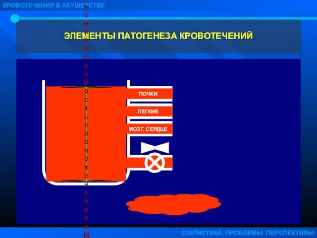 ЭЛЕМЕНТЫ ПАТОГЕНЕЗА КРОВОТЕЧЕНИЙ КРОВОТЕЧЕНИЯ В АКУШЕРСТВЕ СТАТИСТИКА. ПРОБЛЕМЫ. ПЕРСПЕКТИВЫ Объемная скорость кровотечения и ВРЕМЯ