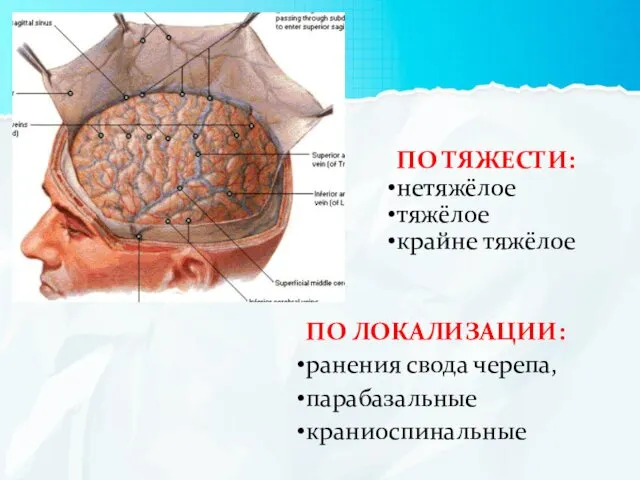 ПО ЛОКАЛИЗАЦИИ: ранения свода черепа, парабазальные краниоспинальные ПО ТЯЖЕСТИ: нетяжёлое тяжёлое крайне тяжёлое