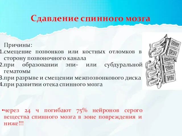 Сдавление спинного мозга Причины: смещение позвонков или костных отломков в