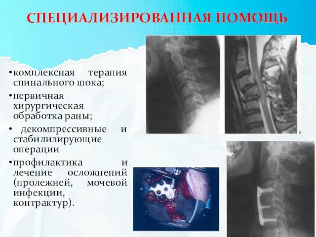 комплексная терапия спинального шока; первичная хирургическая обработка раны; декомпрессивные и