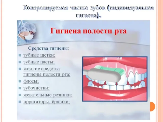 Контролируемая чистка зубов (индивидуальная гигиена).