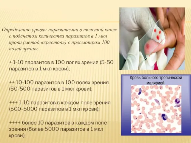 Определение уровня паразитемии в толстой капле с подсчетом количества паразитов