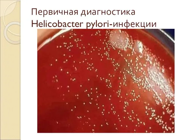 Первичная диагностика Helicobacter pylori-инфекции