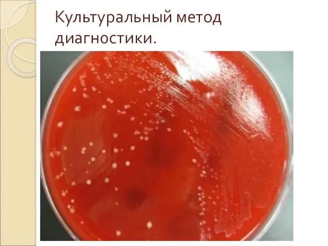 Культуральный метод диагн0стики.