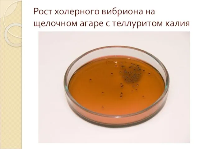 Рост холерного вибриона на щелочном агаре с теллуритом калия