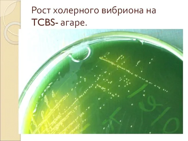 Рост холерного вибриона на TCBS- агаре.