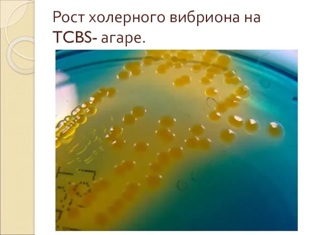 Рост холерного вибриона на TCBS- агаре.