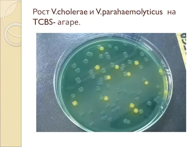 Рост V.cholerae и V.parahaemolyticus на TCBS- агаре.