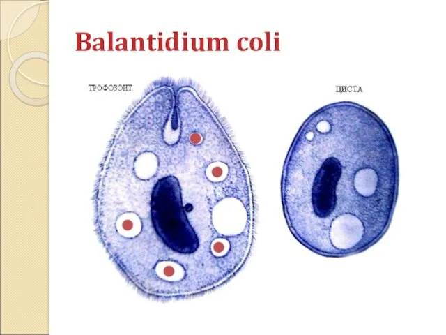 Balantidium coli