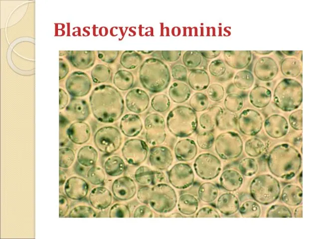Blastocysta hominis