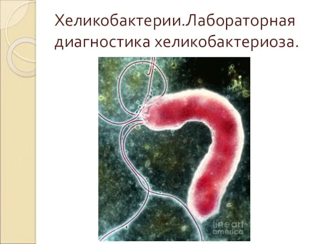 Хеликобактерии.Лабораторная диагностика хеликобактериоза.