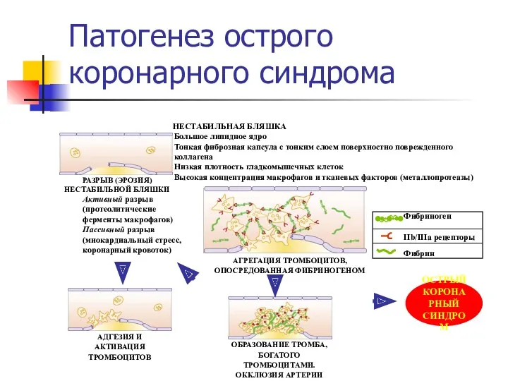 ОСТРЫЙ КОРОНАРНЫЙ СИНДРОМ РАЗРЫВ (ЭРОЗИЯ) НЕСТАБИЛЬНОЙ БЛЯШКИ Фибриноген IIb/IIIa рецепторы