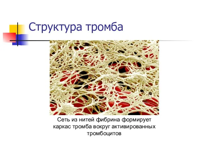 Структура тромба Сеть из нитей фибрина формирует каркас тромба вокруг активированных тромбоцитов
