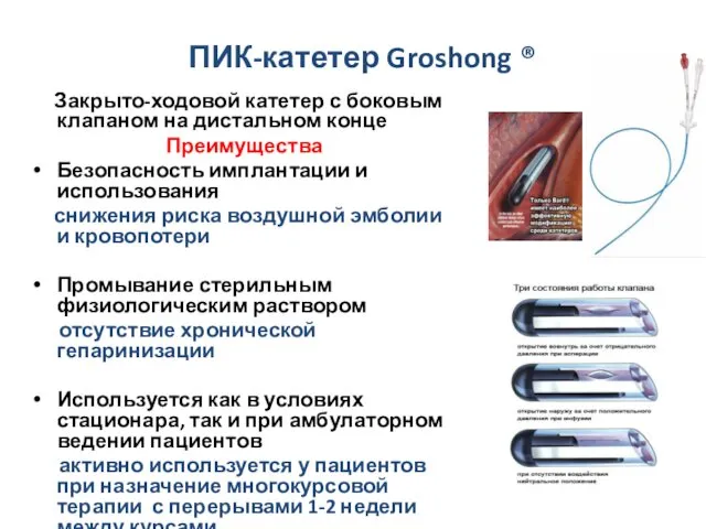 ПИК-катетер Groshong ® Закрыто-ходовой катетер с боковым клапаном на дистальном
