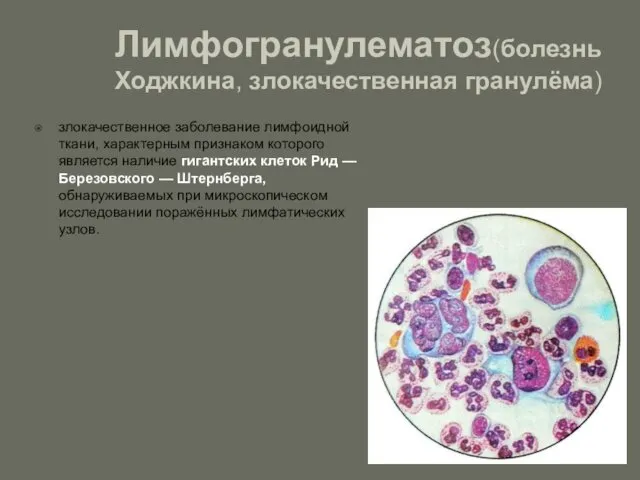 Лимфогранулематоз(болезнь Ходжкина, злокачественная гранулёма) злокачественное заболевание лимфоидной ткани, характерным признаком