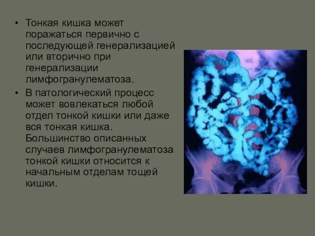 Тонкая кишка может поражаться первично с последующей генерализацией или вторично