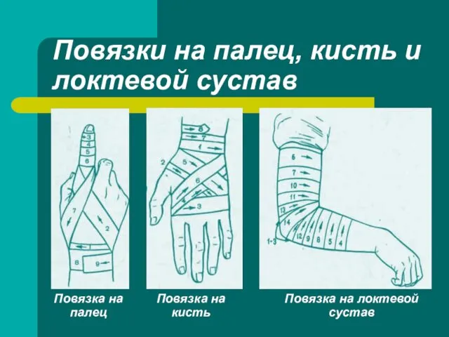 Повязки на палец, кисть и локтевой сустав Повязка на палец