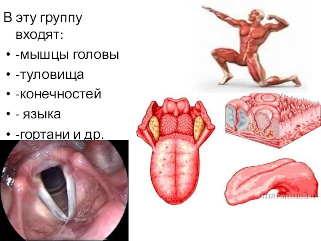 В эту группу входят: -мышцы головы -туловища -конечностей - языка -гортани и др.