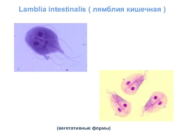 Lamblia intestinalis ( лямблия кишечная ) (вегетативные формы)