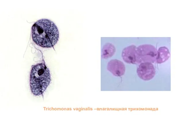 Trichomonas vaginalis –влагалищная трихомонада