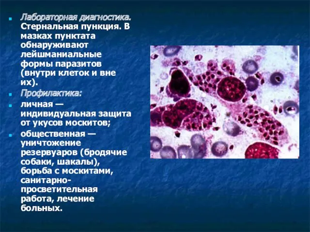 Лабораторная диагностика. Стернальная пункция. В мазках пунктата обнаруживают лейшманиальные формы