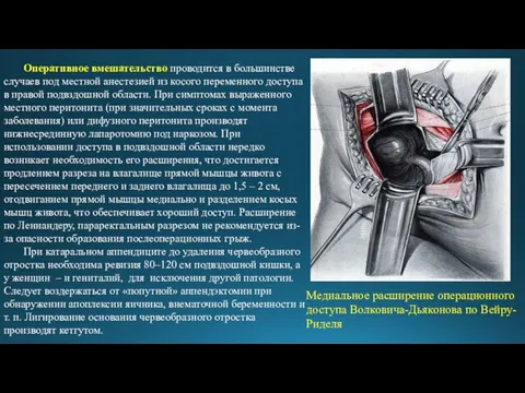 Оперативное вмешательство проводится в большинстве случаев под местной анестезией из