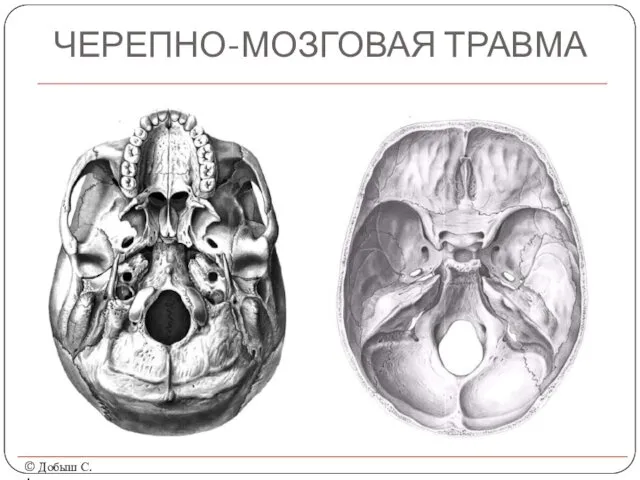 ЧЕРЕПНО-МОЗГОВАЯ ТРАВМА © Добыш С.А.