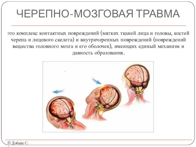 ЧЕРЕПНО-МОЗГОВАЯ ТРАВМА © Добыш С.А. это комплекс контактных повреждений (мягких