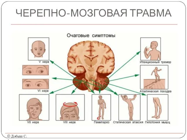 ЧЕРЕПНО-МОЗГОВАЯ ТРАВМА © Добыш С.А.