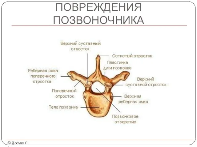 ПОВРЕЖДЕНИЯ ПОЗВОНОЧНИКА © Добыш С.А.