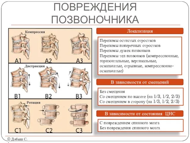 ПОВРЕЖДЕНИЯ ПОЗВОНОЧНИКА © Добыш С.А. Локализация Переломы остистых отростков Переломы