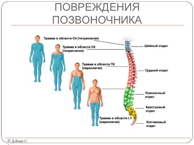 ПОВРЕЖДЕНИЯ ПОЗВОНОЧНИКА © Добыш С.А.