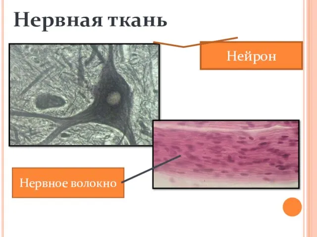 Нервная ткань Нервное волокно Нейрон