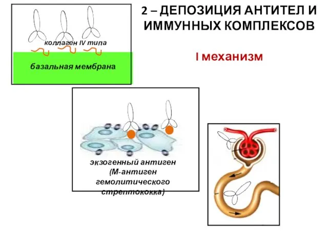 2 – ДЕПОЗИЦИЯ АНТИТЕЛ И ИММУННЫХ КОМПЛЕКСОВ I механизм