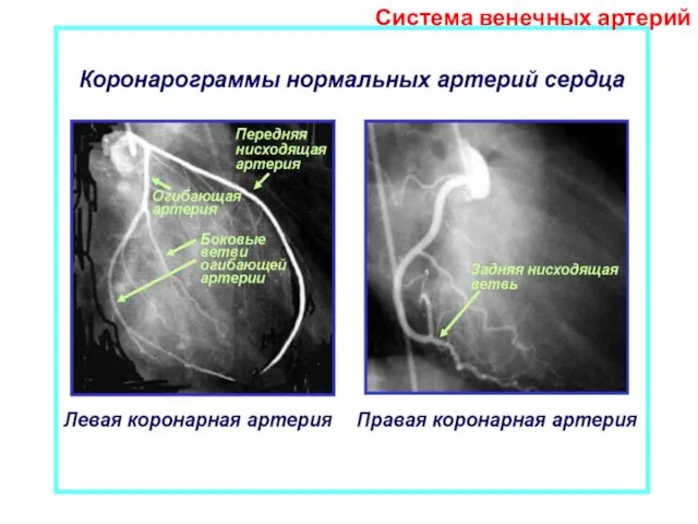 Система венечных артерий