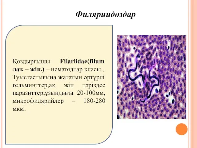 Филяриидоздар Қоздырғышы Filariidae(filum лат. – жіп.) – нематодтар класы .